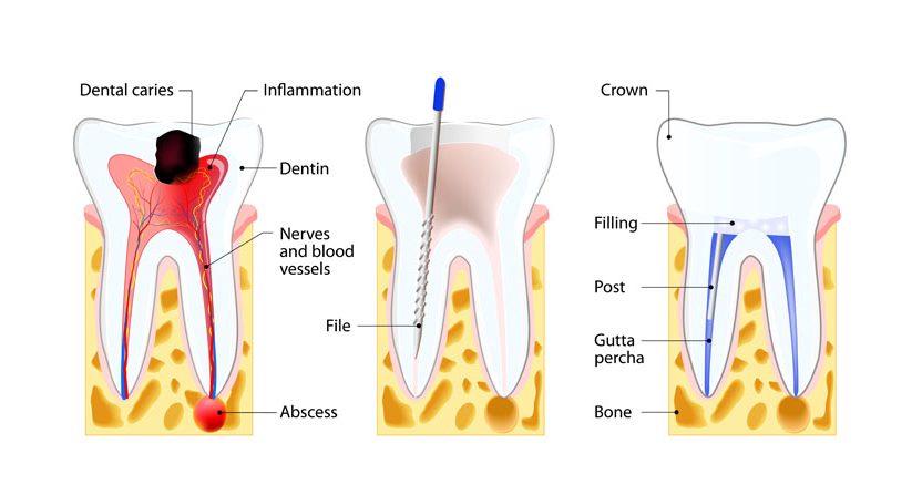 Endodontics