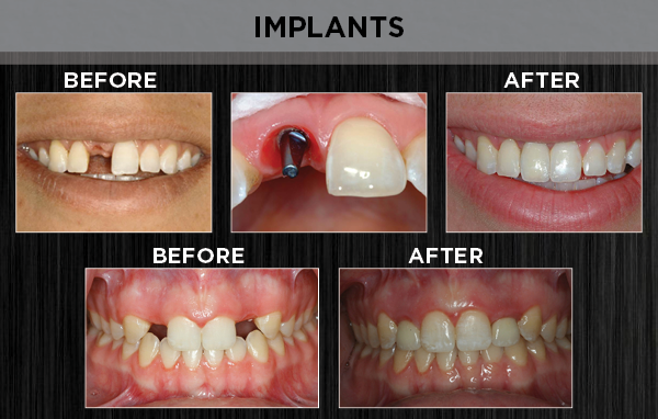 prosthodontics